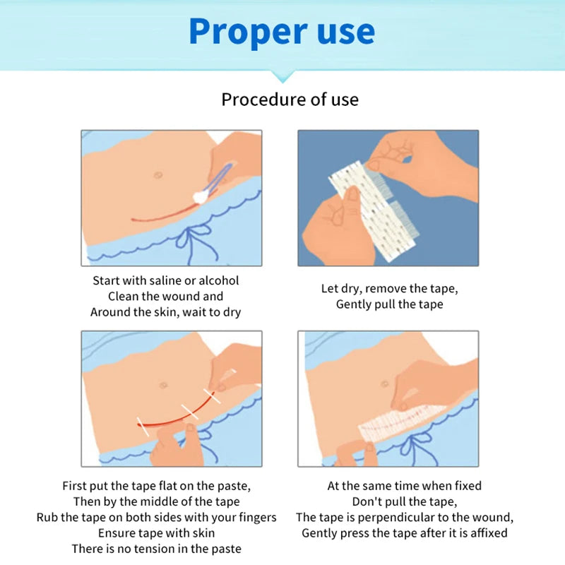 Sterile Strip First Aid Travel Wound Skin Closures Medical Surgical Adhesive